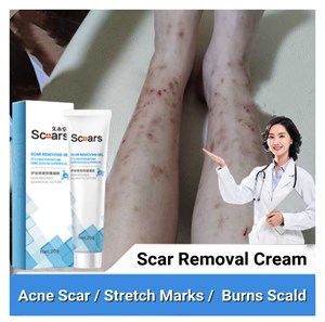 Scar Removal Gel Repair Stretch Marks Burns Old Scars Treatment