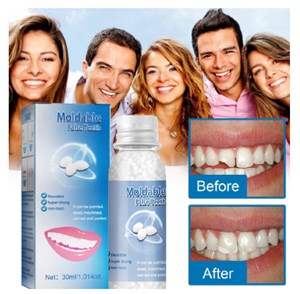 Moldable False Teeth 30ml Temporary Filling Broken Teeth Gap Tooth Repair Kit